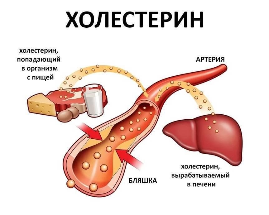 Уровень холестерина в крови таблица