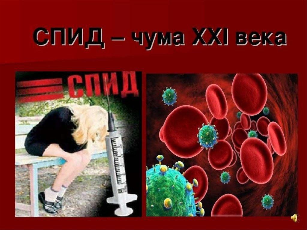 Спид века. СПИД. ВИЧ СПИД. СПИД чума 21 века. СПИД картинки.