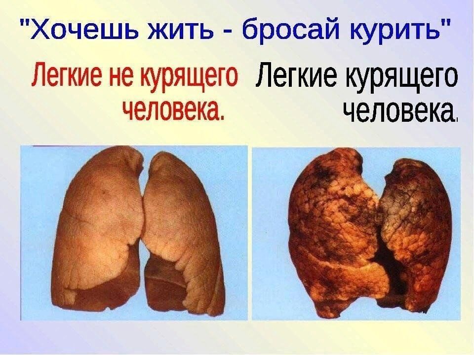 Как выглядят легкие ребенка Тематический час о вреде курения 2023, Семилукский район - дата и место проведен