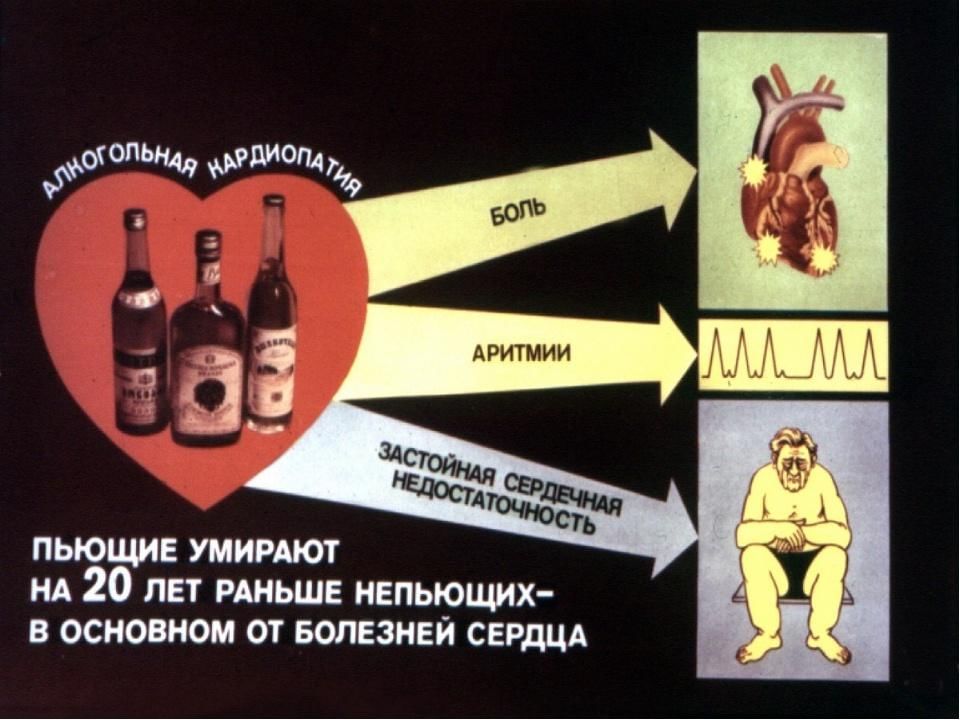 О вреде алкоголя картинки с приколом